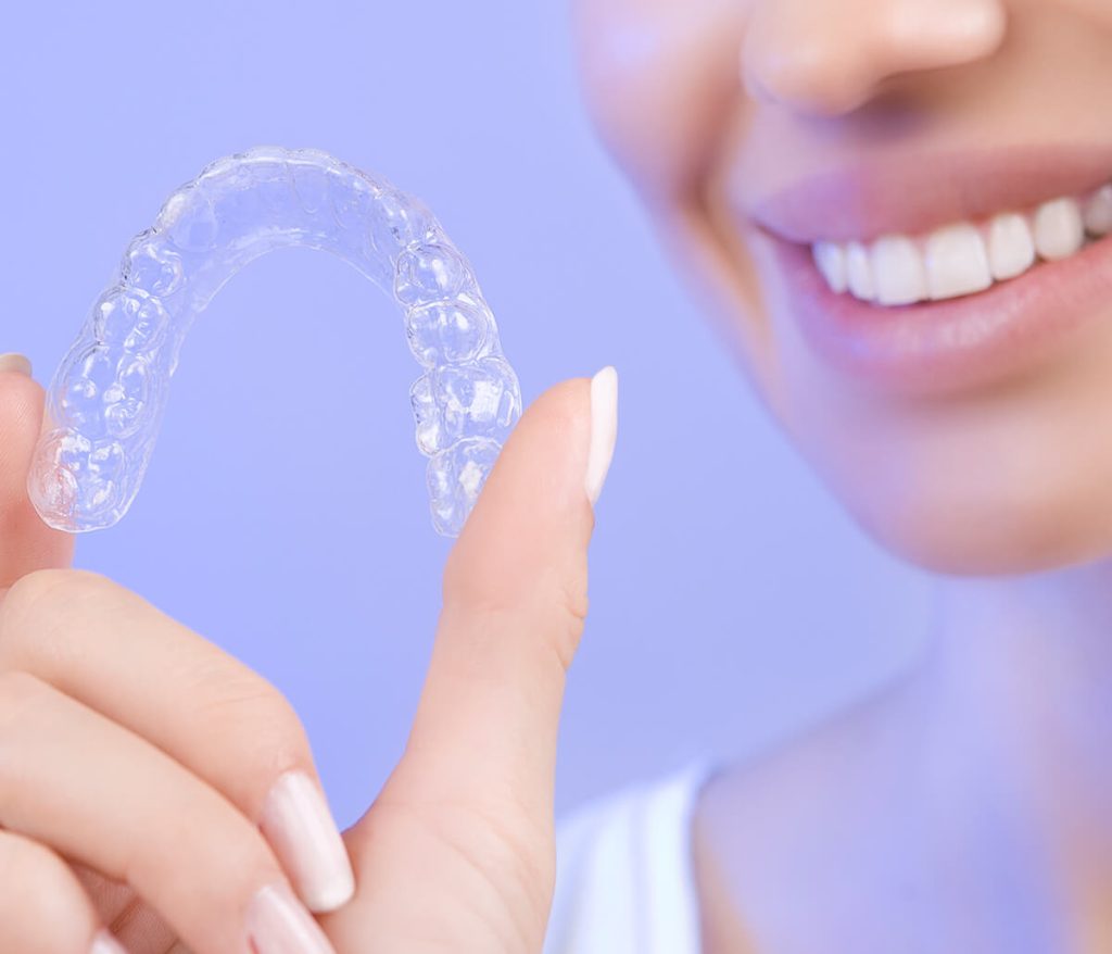Invisalign in Langley: Your Path to a Perfect Smile - Biowiki